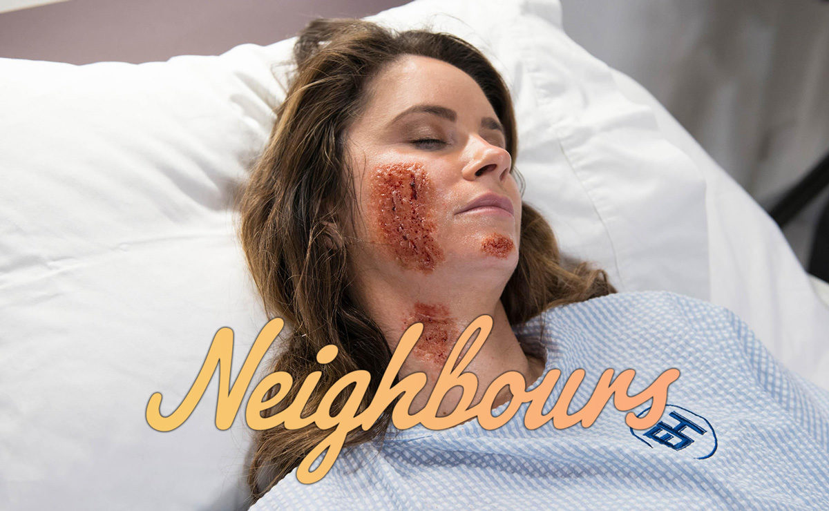 UK Neighbours Spoilers – Scarlett confesses all, as she suffers 3rd degree burns